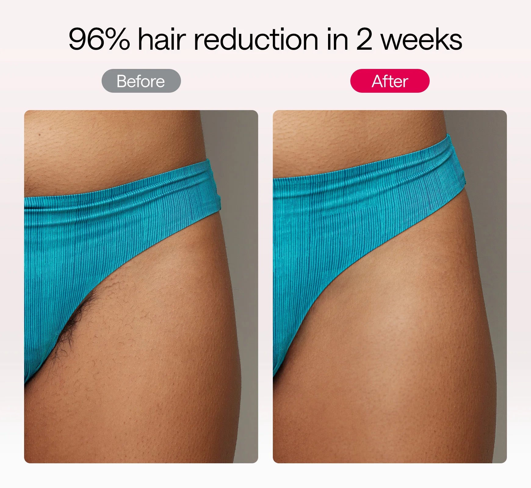 ULIKE Air 10 IPL Hair Removal Device