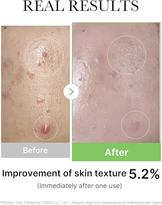 MEDICUBE-EXOSOME CICA AMPOULE 30ML