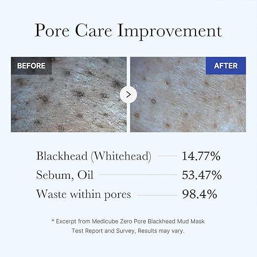 MEDICUBE-ZERO PORE BLACKHEAD MUD MASK 100g