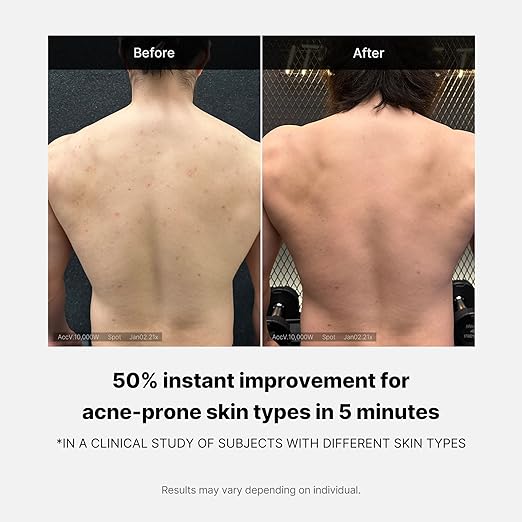 MEDICUBE-RED ACNE BODY WASH 2.0 400g