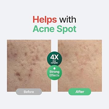 PURITO Wonder Releaf Centella Serum Unscented