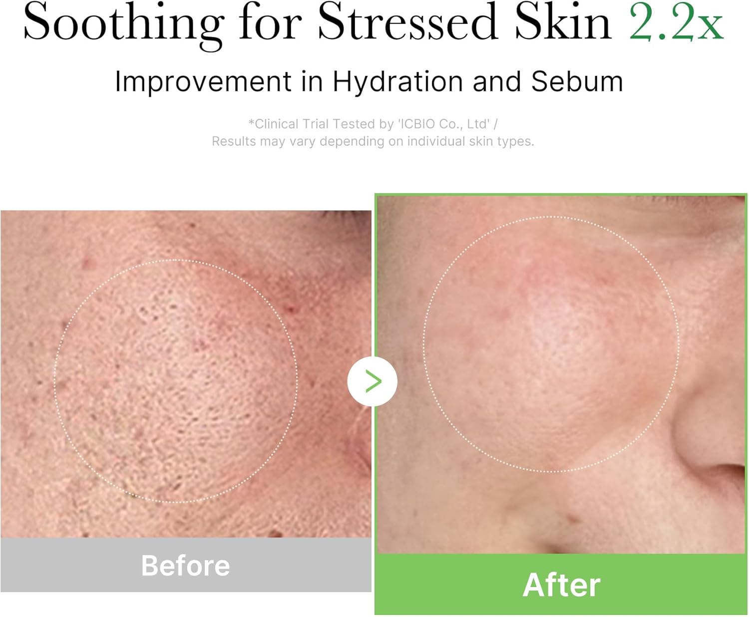 MEDICUBE-EXOSOME CICA CREAM 50ML