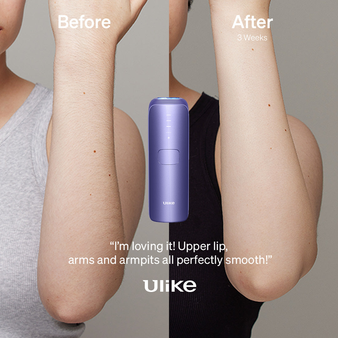 ULIKE Sapphire Air 3 IPL Hair Removal Device