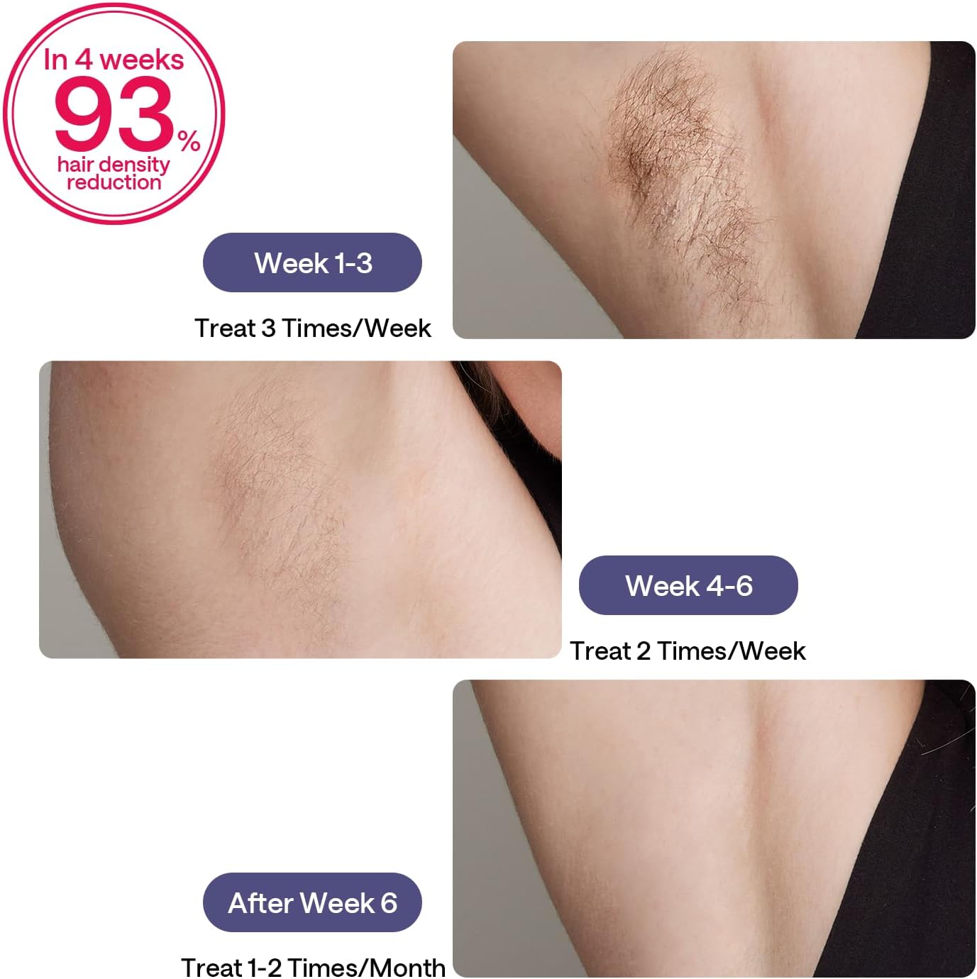 ULIKE Sapphire Air 3 IPL Hair Removal Device