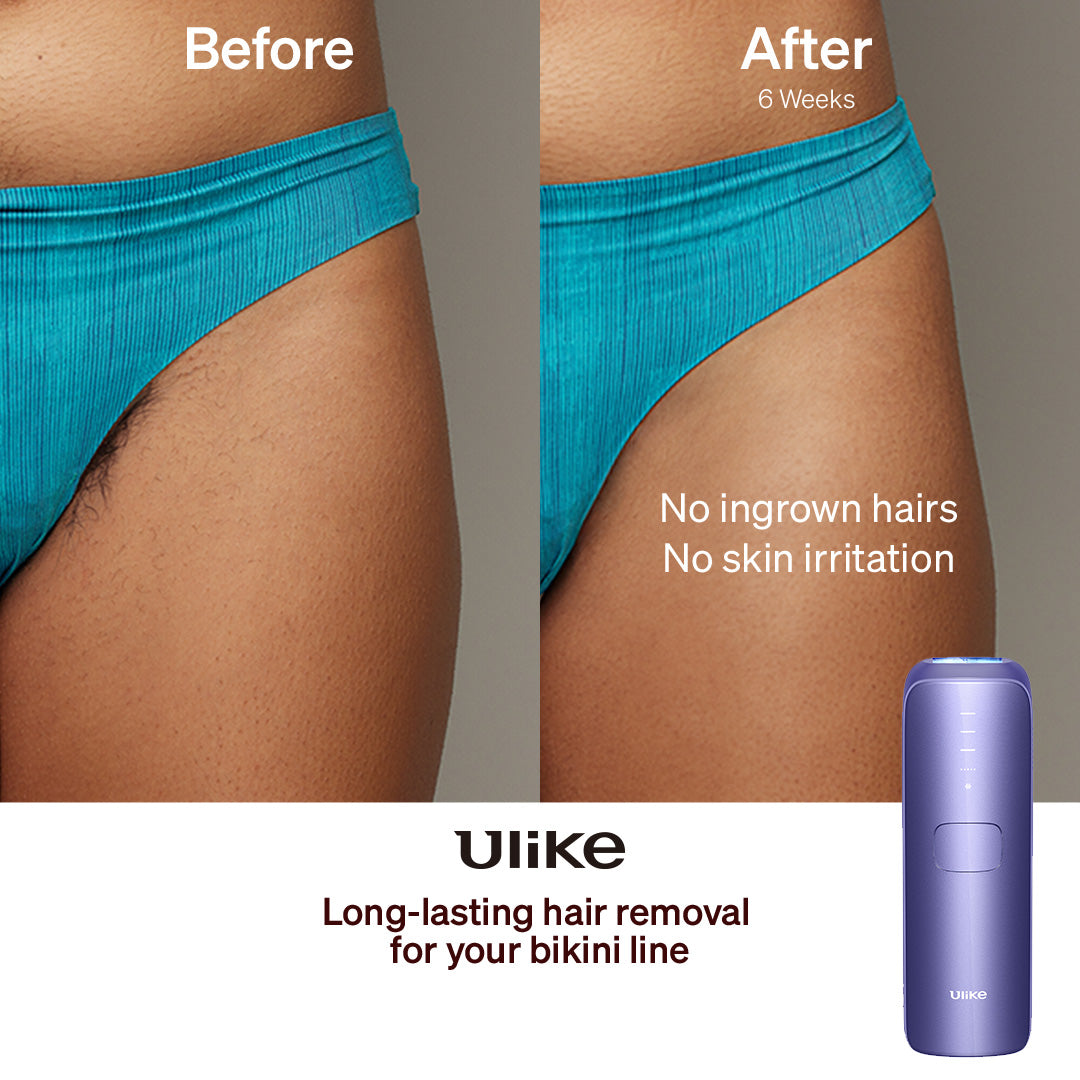 ULIKE Sapphire Air 3 IPL Hair Removal Device