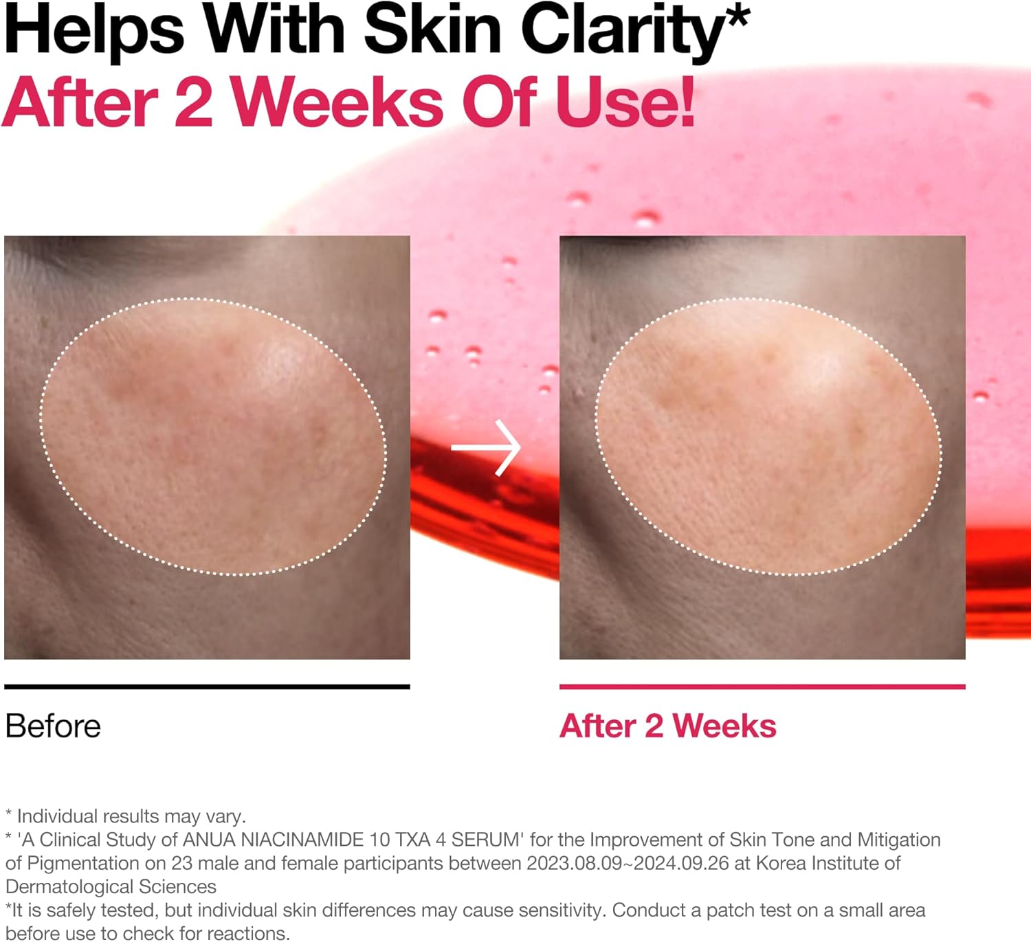 ANUA Niacinamide 10% and TXA 4% Serum 30ML