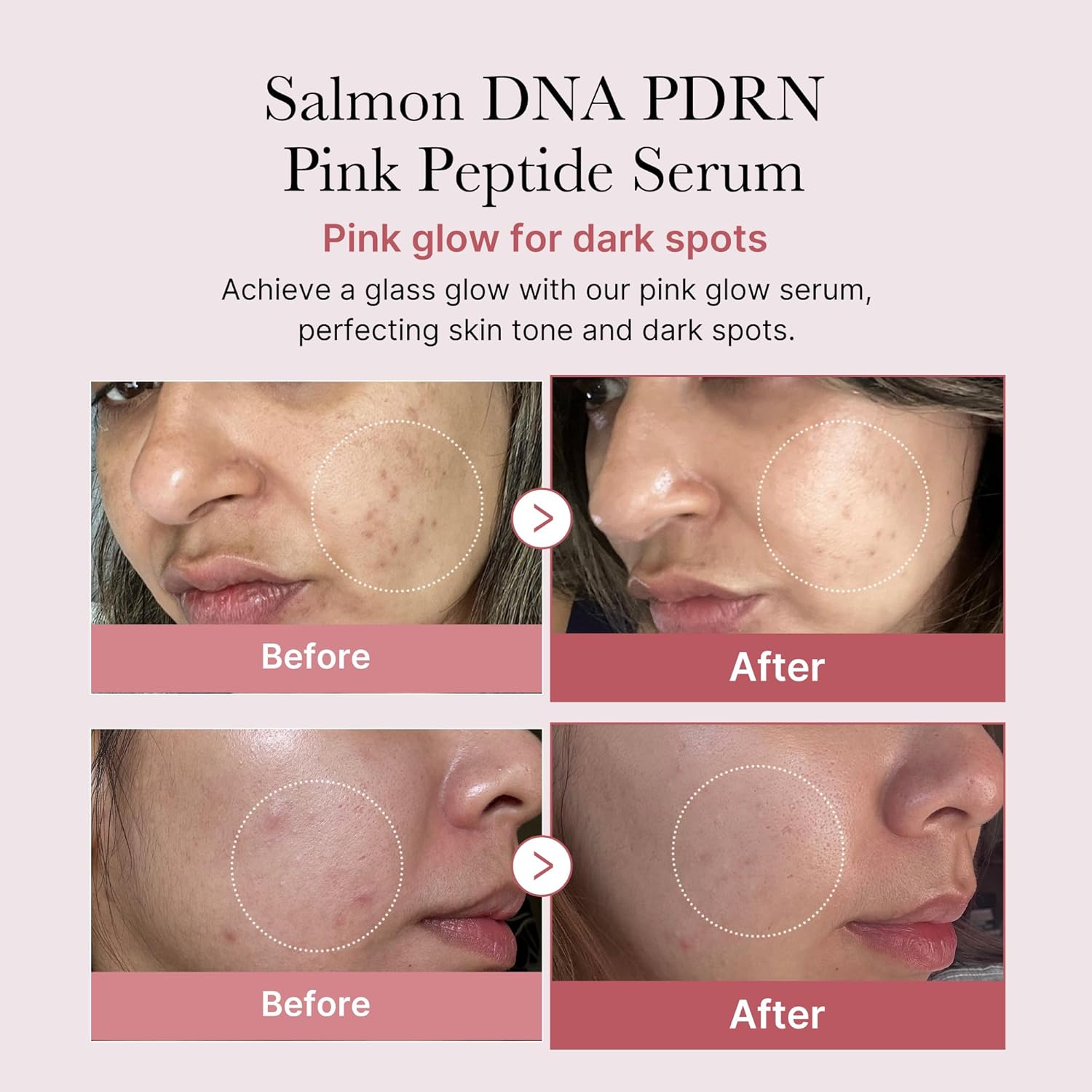MEDICUBE PDRN PINK PEPTIDE SERUM 30ML