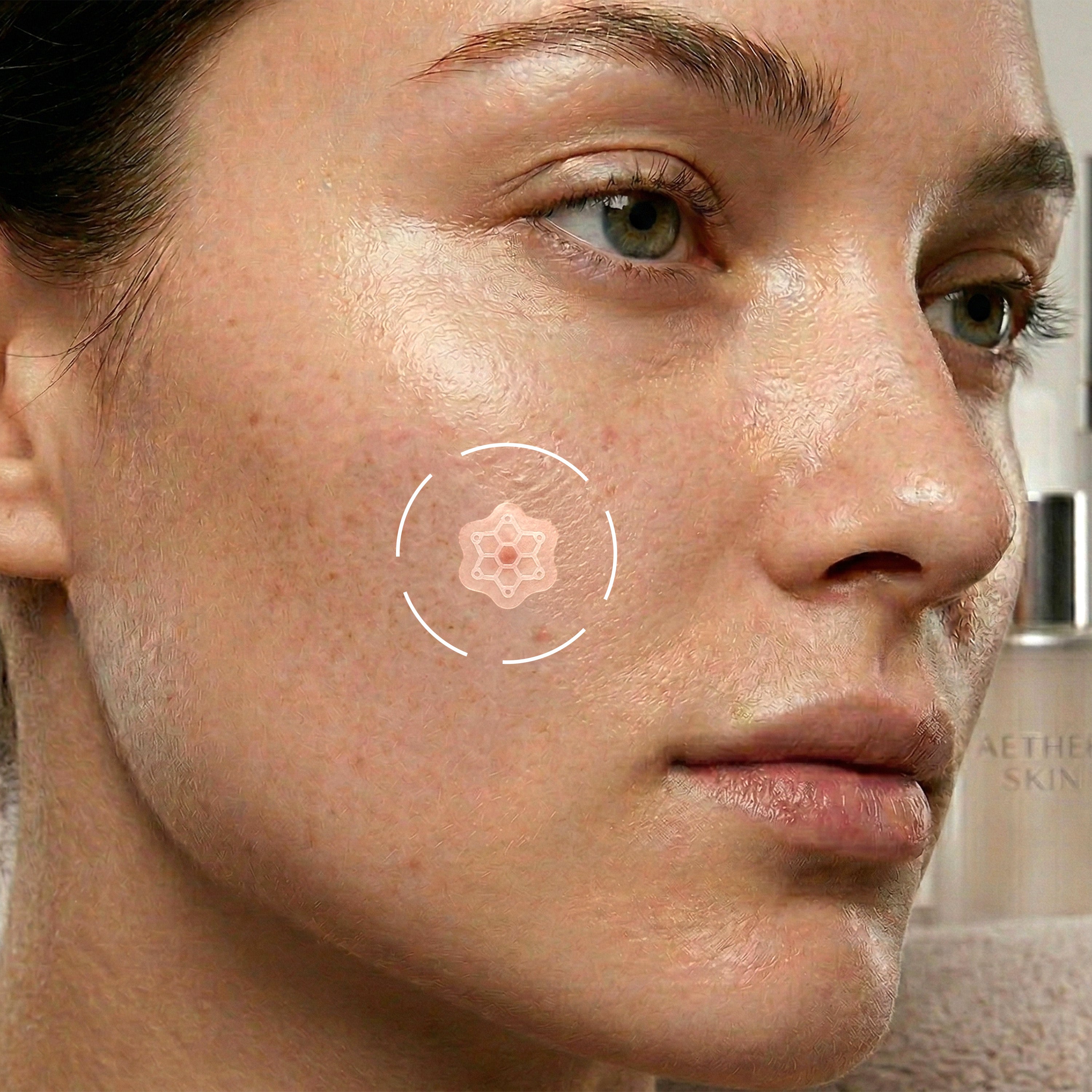 ELLE Magnesium Acne Patch | Micro-Dart | Magnesium - The Magic Mineral | Deep Penetrating Hydrocolloid Pimple Patch | Early Stage & Pus Pimples | Tea Tree & Madecassic Acid | 10 Patches