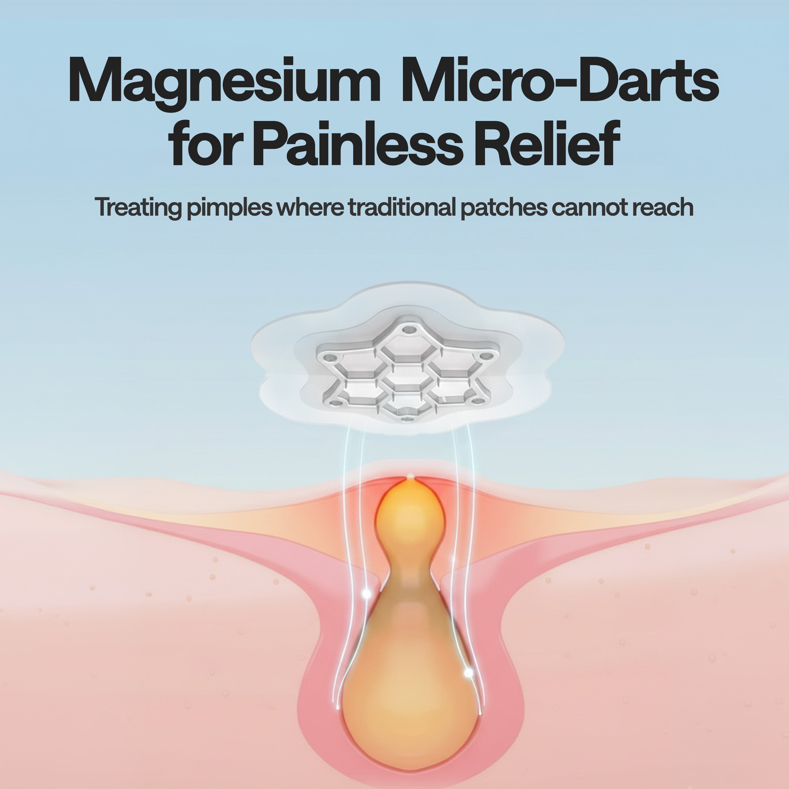 ELLE Magnesium Acne Patch | Micro-Dart | Magnesium - The Magic Mineral | Deep Penetrating Hydrocolloid Pimple Patch | Early Stage & Pus Pimples | Tea Tree & Madecassic Acid | 10 Patches