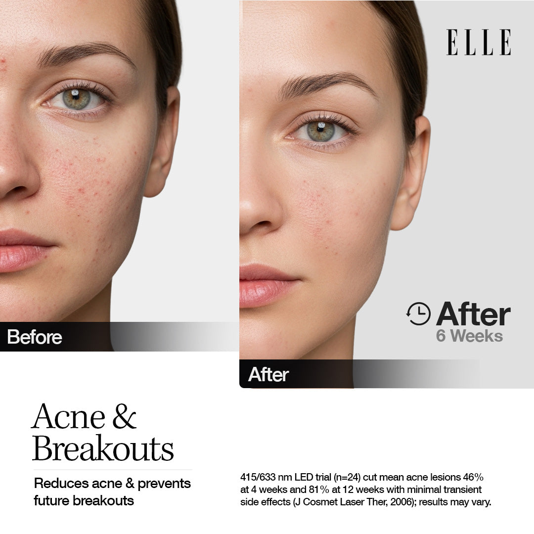 ELLE Radiance Boost Pro LED Face Mask – FDA Approved & Clinically Proven Light Therapy for Glowing, Youthful Skin | Red, Blue & Infrared Light | Boosts Collagen, Reduces Wrinkles, Breakouts & Blemishes | Comfortable Silicone Fit