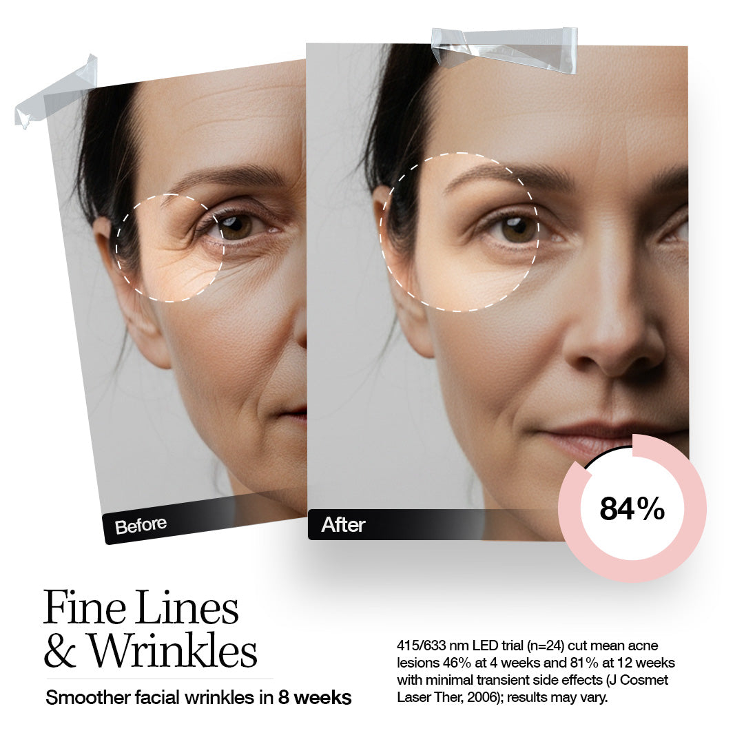 ELLE Radiance Boost Pro LED Face Mask – FDA Approved & Clinically Proven Light Therapy for Glowing, Youthful Skin | Red, Blue & Infrared Light | Boosts Collagen, Reduces Wrinkles, Breakouts & Blemishes | Comfortable Silicone Fit